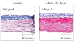 Machinedesign Com Sites Machinedesign com Files Uploads 2015 04 0815 Leah F2 0 Machinedesign Com Sites Machinedesign com Files Uploads 2015 04 0815 Leah F2 0