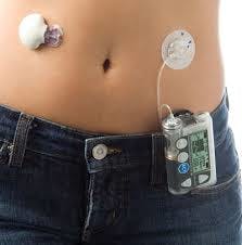 Machinedesign Com Sites Machinedesign com Files Uploads 2015 04 Wearable Medical Device