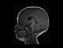 Machinedesign Com Sites Machinedesign com Files Uploads Custom Inline Baby Scan Machinedesign Com Sites Machinedesign com Files Uploads Custom Inline Baby Scan