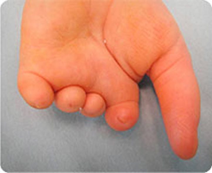 Www Machinedesign Com Sites Machinedesign com Files Enable Short Fingers