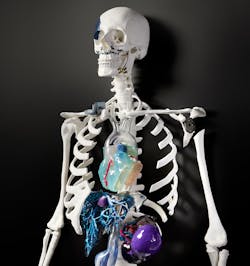 Www Machinedesign Com Sites Machinedesign com Files Freddie 3 D Models And Implants Within 3 D Skeleton2 Www Machinedesign Com Sites Machinedesign com Files Freddie 3 D Models And Implants Within 3 D Skeleton2