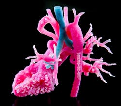 Www Machinedesign Com Sites Machinedesign com Files Heart 2 Www Machinedesign Com Sites Machinedesign com Files Heart 2