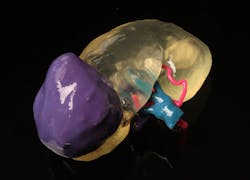 Www Machinedesign Com Sites Machinedesign com Files Kidney Model Www Machinedesign Com Sites Machinedesign com Files Kidney Model