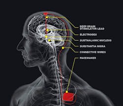 Www Machinedesign Com Sites Machinedesign com Files Brain Image 2 0 Www Machinedesign Com Sites Machinedesign com Files Brain Image 2 0