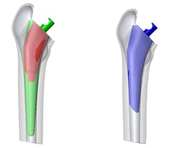 Www Machinedesign Com Sites Machinedesign com Files Femur Web Www Machinedesign Com Sites Machinedesign com Files Femur Web
