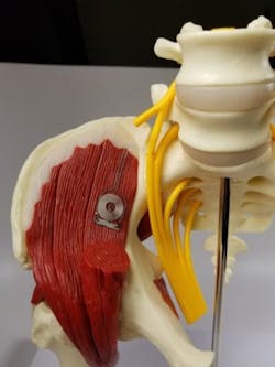 Www Machinedesign Com Sites Machinedesign com Files Bio Electric Attached Node To Muscle 2 Www Machinedesign Com Sites Machinedesign com Files Bio Electric Attached Node To Muscle 2