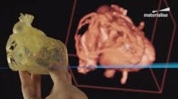 Www Machinedesign Com Sites Machinedesign com Files Materialise Models 0 Www Machinedesign Com Sites Machinedesign com Files Materialise Models 0