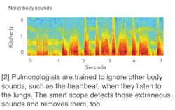 Www Machinedesign Com Sites Machinedesign com Files Image 4 Noisy Body Sounds 0 Www Machinedesign Com Sites Machinedesign com Files Image 4 Noisy Body Sounds 0