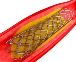 Www Machinedesign Com Sites Machinedesign com Files Wtd Grinding Stint 0 Www Machinedesign Com Sites Machinedesign com Files Wtd Grinding Stint 0