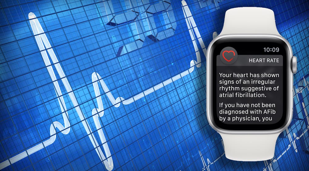 The Apple Watch can monitor a wearer&rsquo;s heart rate and keep track of irregular rhythms.