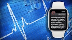 The Apple Watch can monitor a wearer&rsquo;s heart rate and keep track of irregular rhythms.