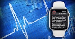Apple Watch Apple Watch