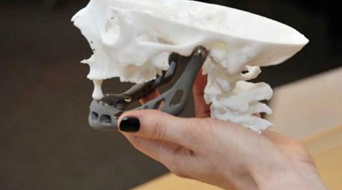 Machinedesign 6292 83 3d Printed Jaw 4 537x392 0