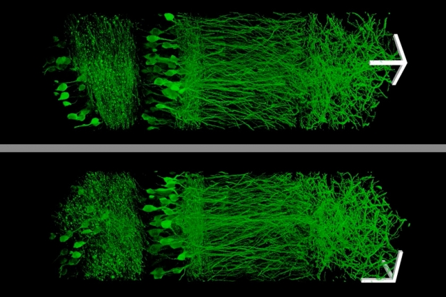 The expanded neurons from the hippocampus are on the right They are more easily observed than the original condensed neurons on the left