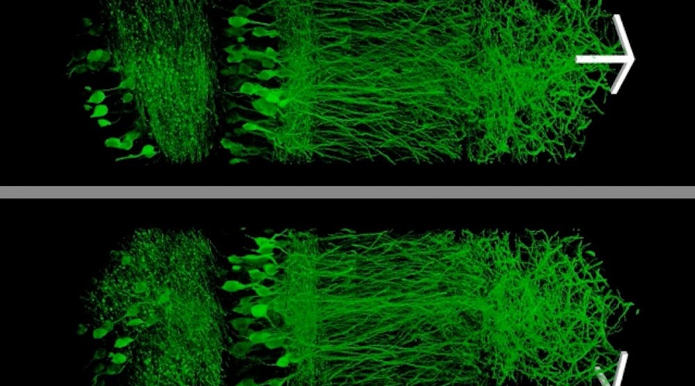 The expanded neurons from the hippocampus are on the right. They are more easily observed than the original condensed neurons on the left.