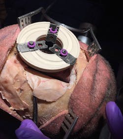 Machinedesign Com Sites Machinedesign com Files G2 Radiex Machinedesign Com Sites Machinedesign com Files G2 Radiex