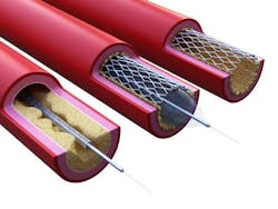 Machinedesign Com Sites Machinedesign com Files Stent 2 Machinedesign Com Sites Machinedesign com Files Stent 2