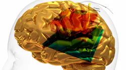 Brain