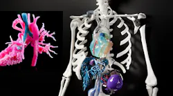 3D models and implants