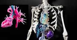 3D models and implants 3D models and implants