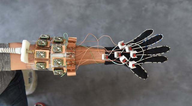 The new MRI glove, designed by the medical research team at NYU School of Medicine, can capture MRI moving images of a patient&rsquo;s bone, tendons, muscles, and ligaments.