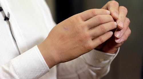 The Hennes robotic hand is a single motor driven prosthetics developed by the Italian Institute of Technology and the INAIL state workers’ compensation prosthetic center. It is an attempt to build a lightweight and cheaper prosthetic. The Hennes robotic hand is a single motor driven prosthetics developed by the Italian Institute of Technology and the INAIL state workers’ compensation prosthetic center. It is an attempt to build a lightweight and cheaper prosthetic.