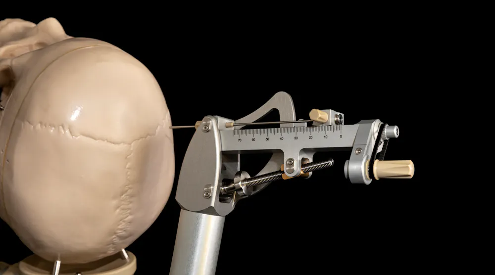 Innovations in Deep-Brain Simulation Advanced Brain Surgery | Machine ...