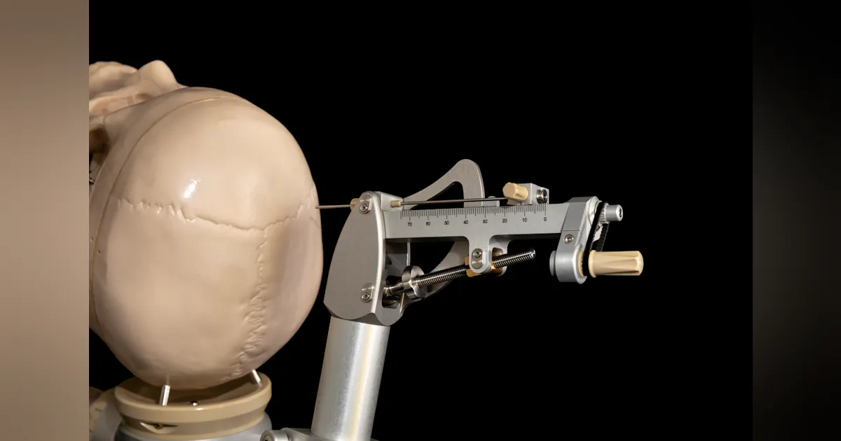 Innovations in Deep-Brain Simulation Advanced Brain Surgery | Machine ...