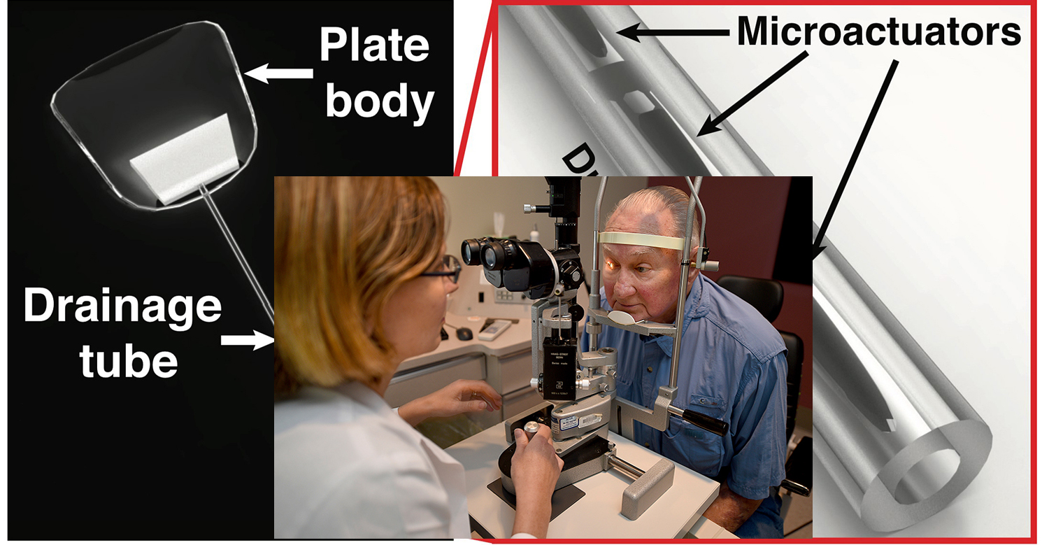 Purdue's drainage device