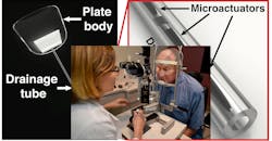 Purdue's drainage device Purdue's drainage device