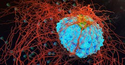 Cancer cell Cancer cell