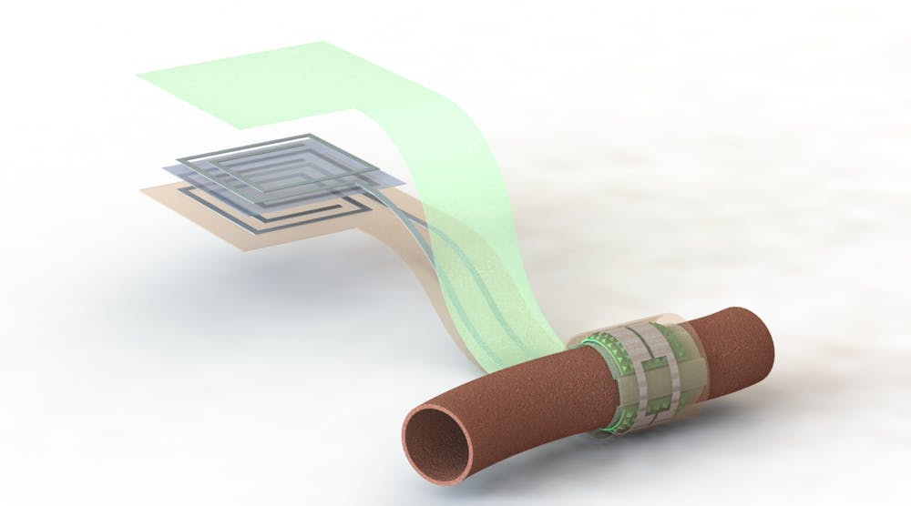 Artist&rsquo;s depiction of the biodegradable pressure sensor wrapped around a blood vessel with the antenna off to the side (layers separated to show details of the antenna&rsquo;s structure).