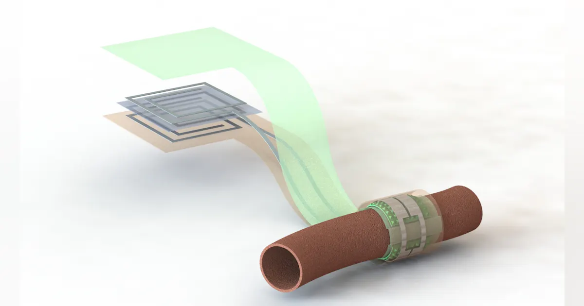 Battery Free Sensor Wireless, Battery-Free Sensor Monitors Blood Flow | Machine Design