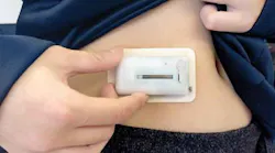 Diabetes pump connector