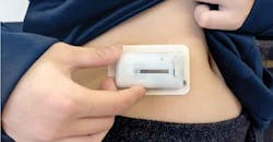 Diabetes pump connector Diabetes pump connector