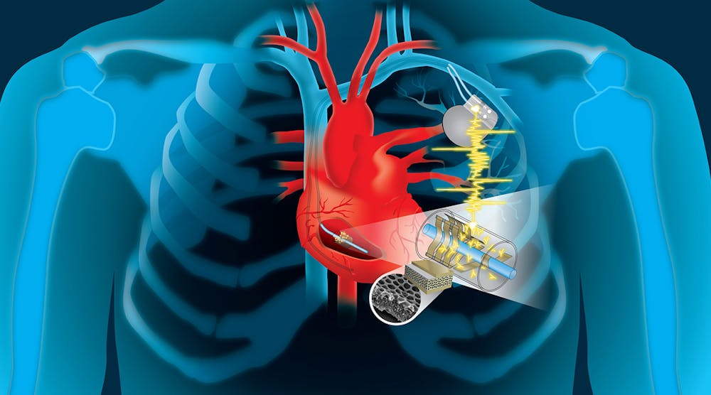 Rendering of the two designs of the cardiac energy harvesting device.