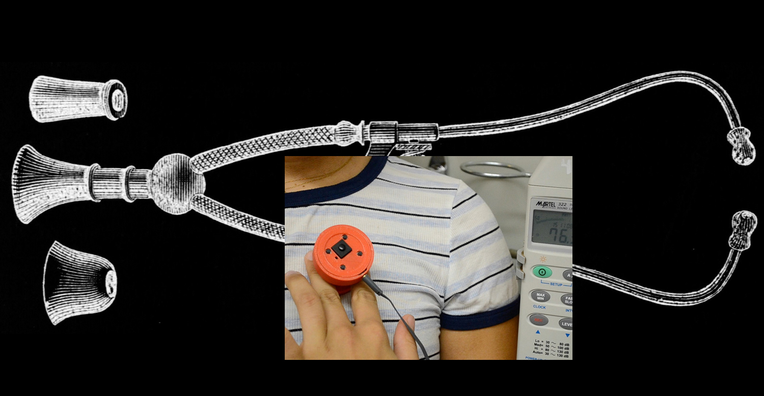 Johns Hopkins smart stethoscope