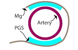 Machinedesign Com Sites Machinedesign com Files Ed Blood Flow Fig2 Machinedesign Com Sites Machinedesign com Files Ed Blood Flow Fig2