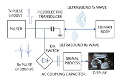 Machinedesign Com Sites Machinedesign com Files Fig02 Ultrasound System 0 Machinedesign Com Sites Machinedesign com Files Fig02 Ultrasound System 0
