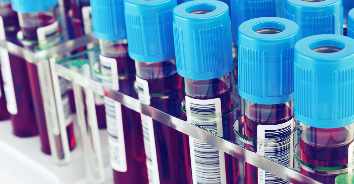 PROMO_blood_test_header_3-2.jpg