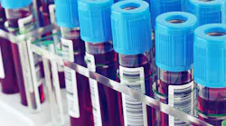 PROMO_blood_test_header_3-2.jpg