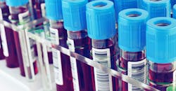 PROMO_blood_test_header_3-2.jpg PROMO_blood_test_header_3-2.jpg