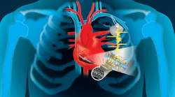 Piezo-Based Energy Harvesting for Medical Implants May Transcend Alternative Approaches