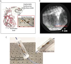 Machinedesign Com Sites Machinedesign com Files Pet Pacemaker Harvesting Fig1 Web Machinedesign Com Sites Machinedesign com Files Pet Pacemaker Harvesting Fig1 Web
