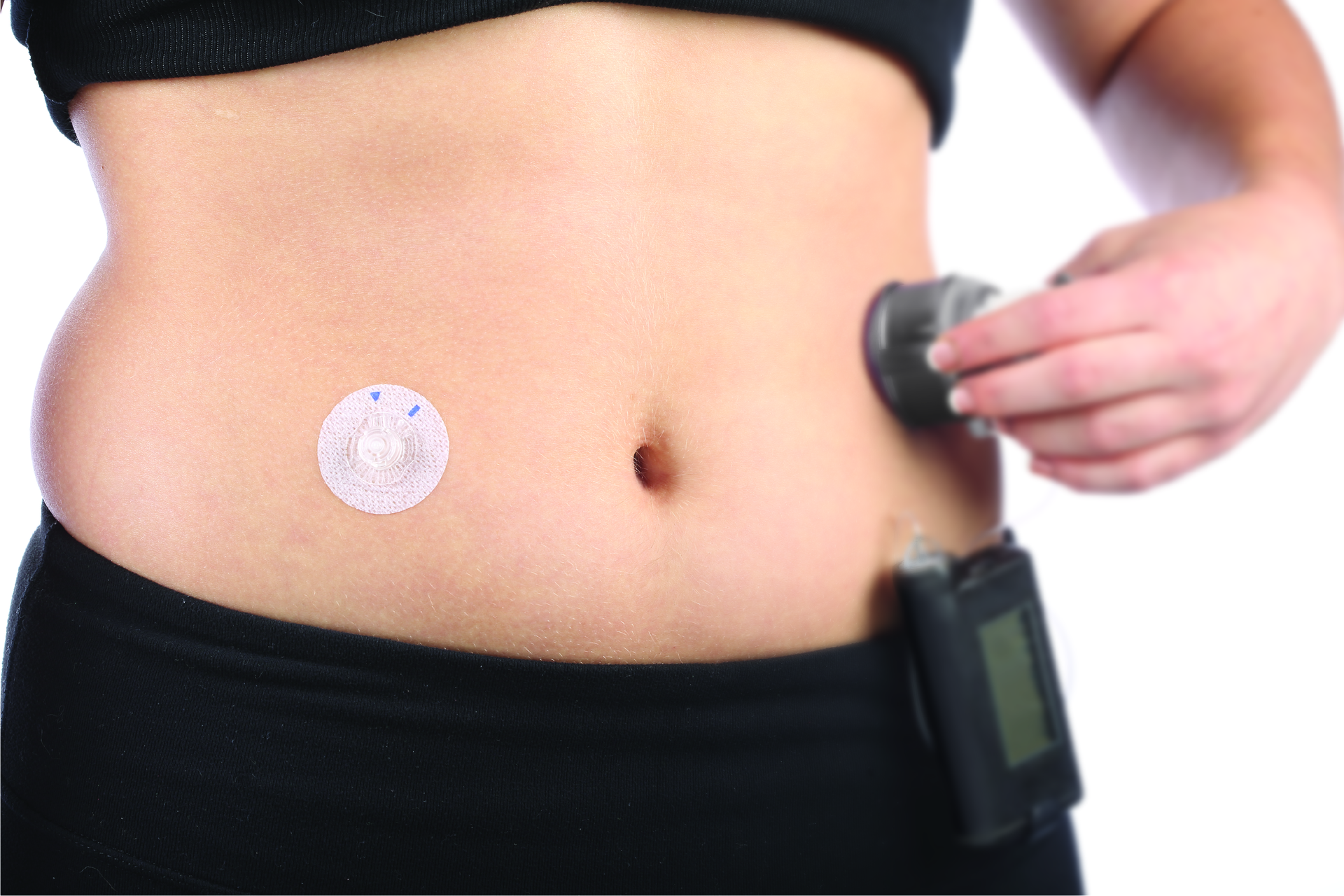 Glucose monitor