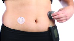 As medical wearables become more common, such as this glucose monitor to help people manage their diabetes, adhesives will be used to keep them in contact with the patients.