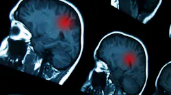 Brain