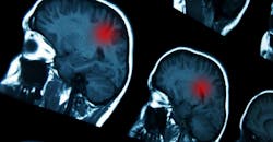 Brain Brain