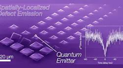 False-color scanning electron micrograph