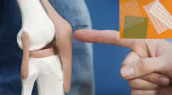 3D meshes